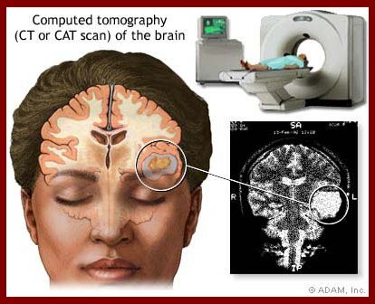 brain scan.jpg